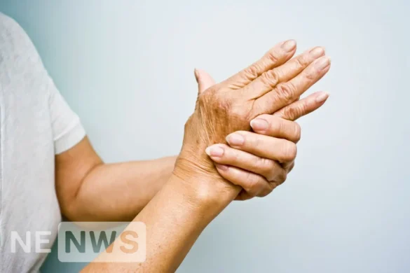 Артрит симптоми: 5 ранніх сигналів, на які слід звернути увагу