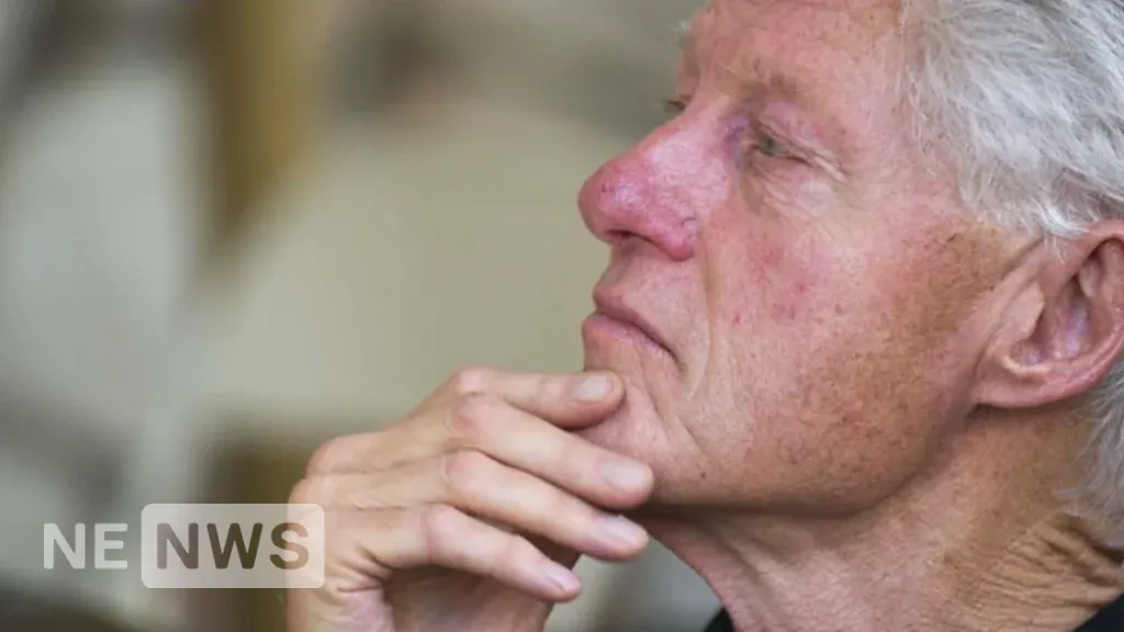 Former US President Bill Clinton has symptoms of rosacea
