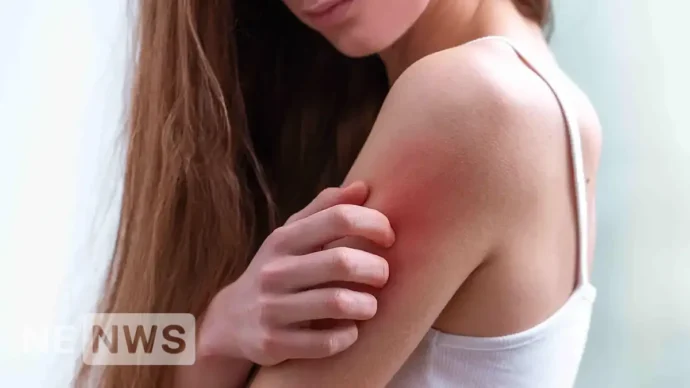 Що робити, якщо чиряк не прориває? Методи допомоги