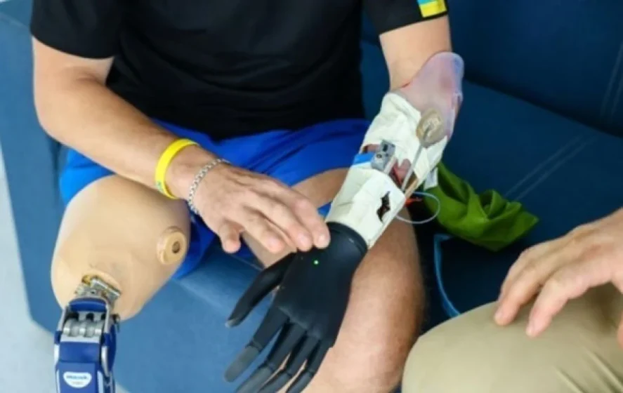 Ісландія та EmblaMedical підтримають українських захисників: нова ініціатива з протезування